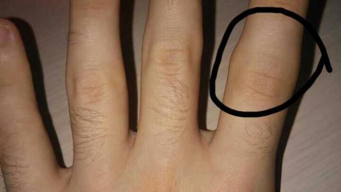 Arkadaşlar sizce bu çıkık mı?