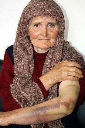 Türk kadını neden dayak yiyor?