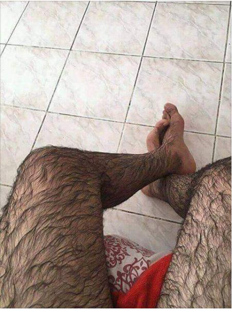 Bacak kıllarımın düz durması için ne yapabilirim. Yardımcı olur musunuz?