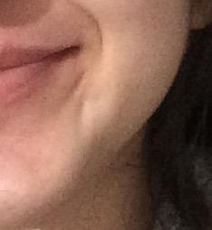 Bu gamze mi oluyor?