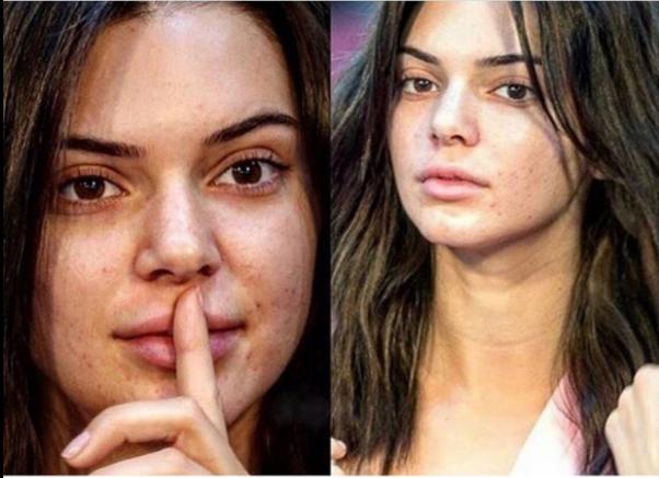 Candice Swanepoel Mi Yoksa Kendall Jenner Mı?