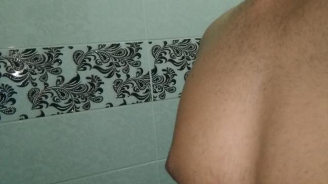 Jinekomasti değilim ancak Göğüslerim bir tuhaf?(Resimli)?