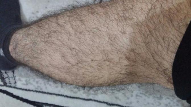Bacaklarim çok mu kıllı? Yoksa sizce normal mi?