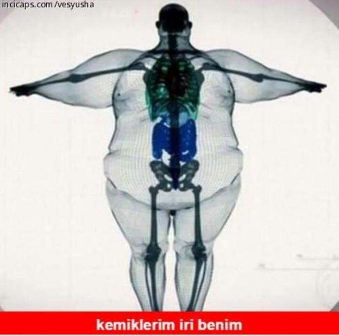 Kemikleriniz mı iri yoksa şişkomusunuz 😁?