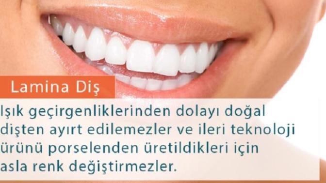Laminat veneer yaptırdım, ton farkı oldu. Renk değişimi olur mu zamanla?