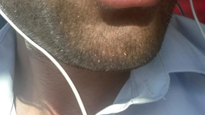 Üst dudağı ince olan kizlar itici degil mi?