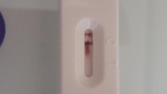 Gebelik kahverengi akıntı adet lekeler?