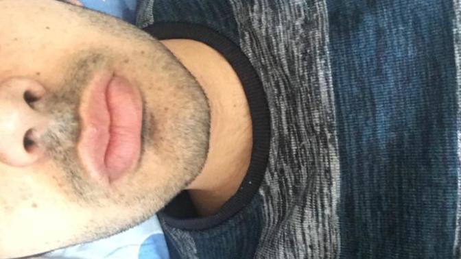 Dudaklarım büyük diye Kendimi sıkıyorum? Sizce?