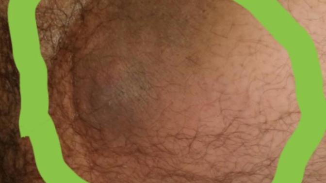 Bacak aramda bu var, geçer mi 😭 (RESİMLİ) ?