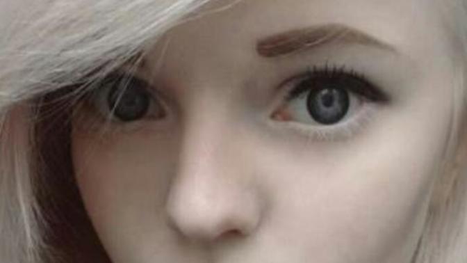 Albino hastası olup bu kadar yakışıklı ve güzel olmak? sizce nasıl?😍👍😍?