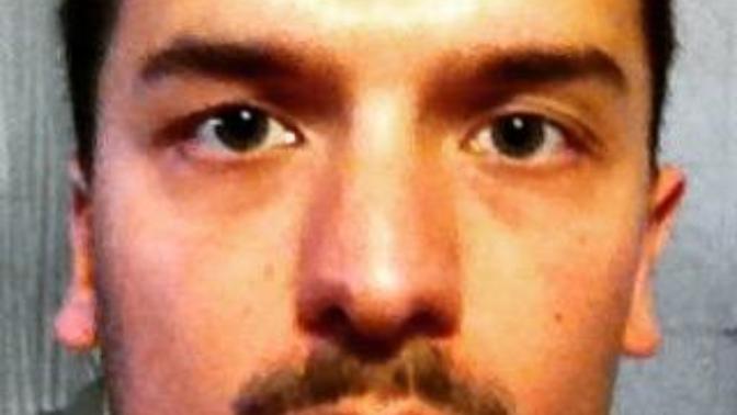 Bıyıgım kılları üstü burnumdan direk üste doğru çıkıyor ne yapsam ?