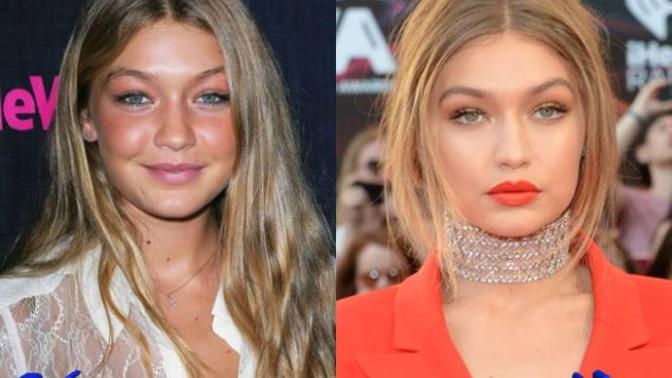 Sizce gigi hadidte estetik var mı?