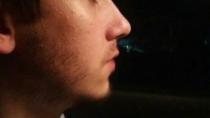 Burnum Nasıl Acaba?