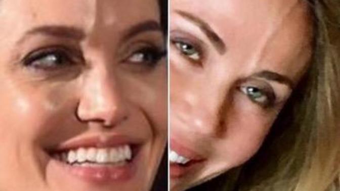 Fotoğraftaki örneklerdeki gibi alnında belirgin damara sahip olan var mı?
