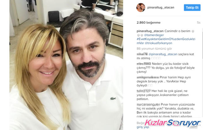 Pınar Altuğ' da büyük değeşiklik! Sizce estetik mi, değil mi?