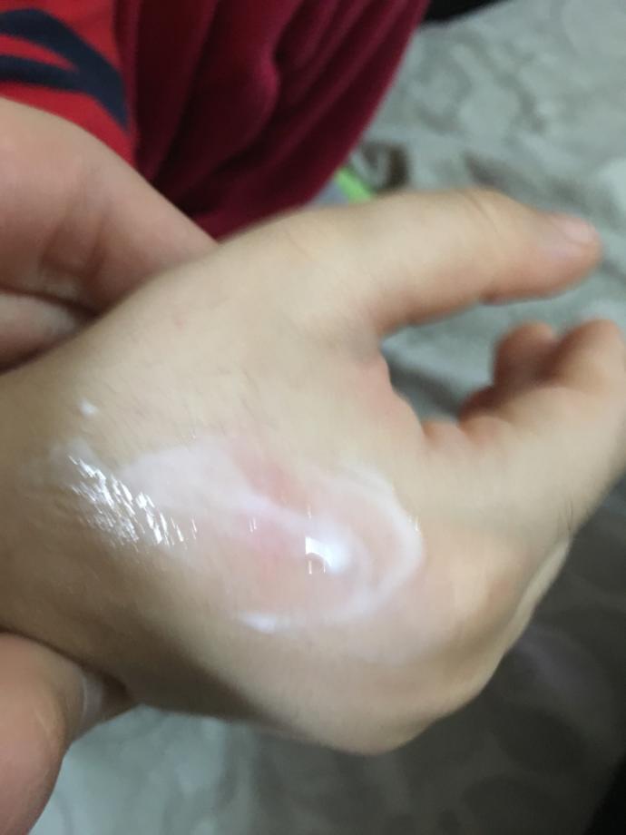 Kardeşimle şakalaşırken elini yaktım ???