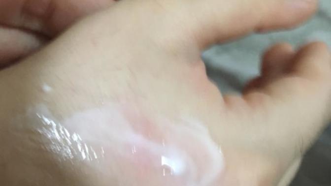 Kardeşimle şakalaşırken elini yaktım?