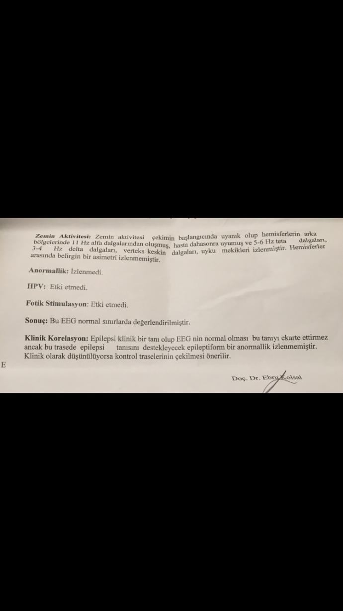 Millet bu ne demek eeg ve mr sonucu?