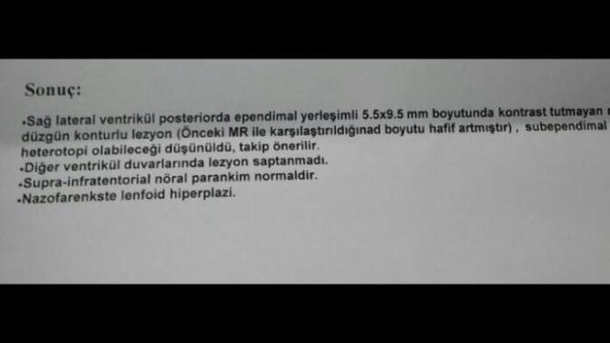 Millet bu ne demek eeg ve mr sonucu?