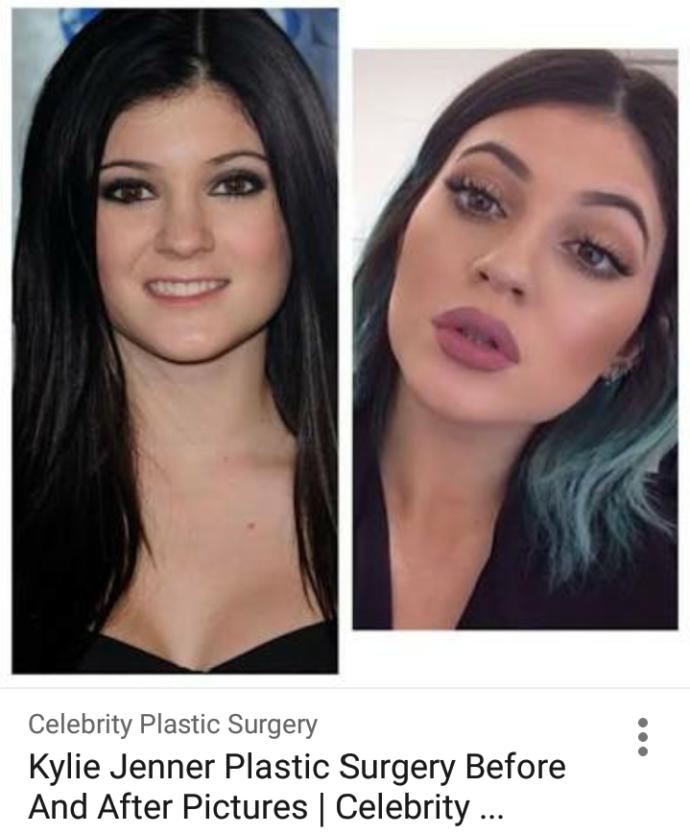 Estetik geçirsem kylie jenner'dan güzel olurum diyenler kimler? 