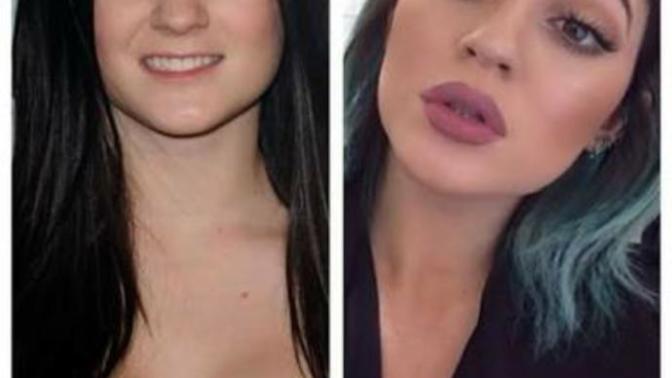 Estetik geçirsem kylie jenner'dan güzel olurum diyenler kimler?