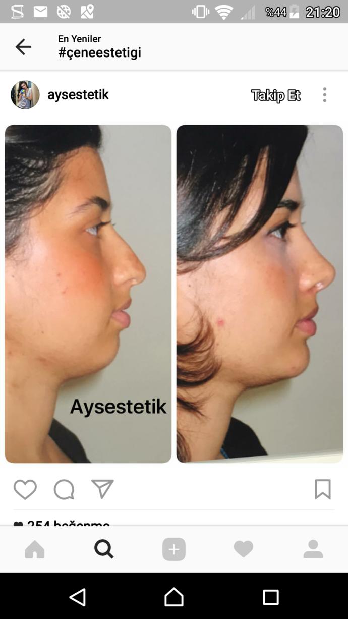 Ya çok güzelim ya çok çirkin ben neyim şimdi?