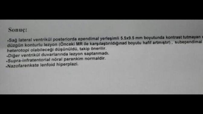 Bu nedir beyin mrsi?