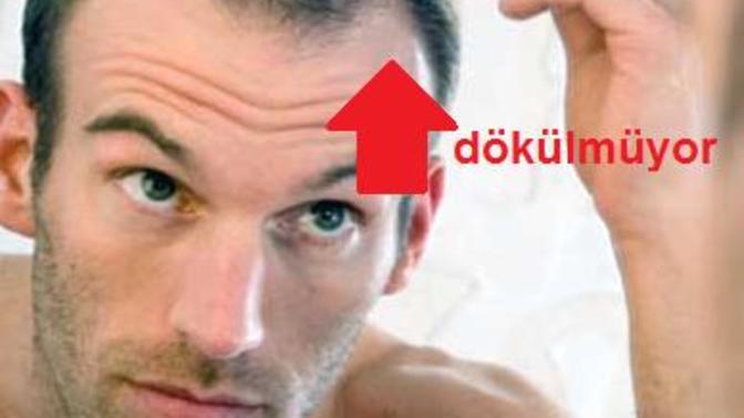 Saçımın sağ tarafı dökülüyor, sol tarafı dökülmüyor. Nedendir acaba?