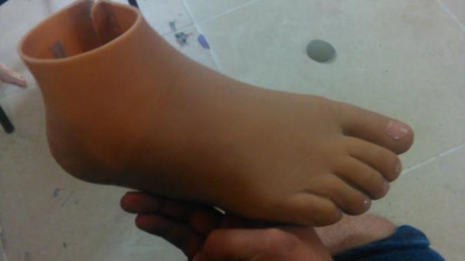 Protez ayak kullanan biri ile evlenmeyi düşünür müydün?