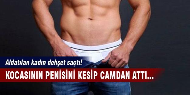 Eşinin penisini kesip camdan attı ?
