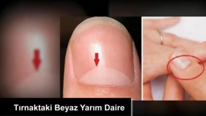 Baş parmağınızdaki tırnağın başlangıc yerinde , yarım daire şeklindeki beyazlığın sebebi ne hiç düşündünüz mü?