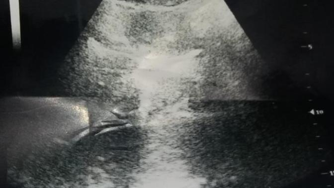 Bu ultrasonda bebek görebilen var mı?
