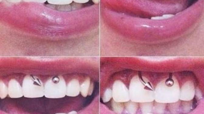 Smiley piercing yaptırdım, bakımı hakkında bilgi verebilir misiniz?
