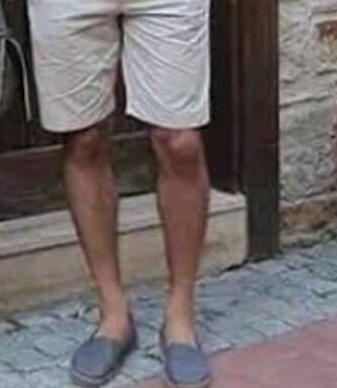 Bu bacaklar çarpıklık kategorisini giriyor mu ( Parantez Bacak)?