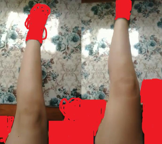 Sizce bu bacak kalın mı normal mi?