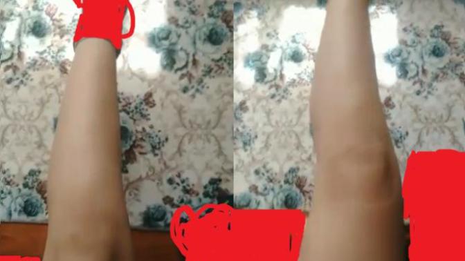 Sizce bu bacak kalın mı normal mi?