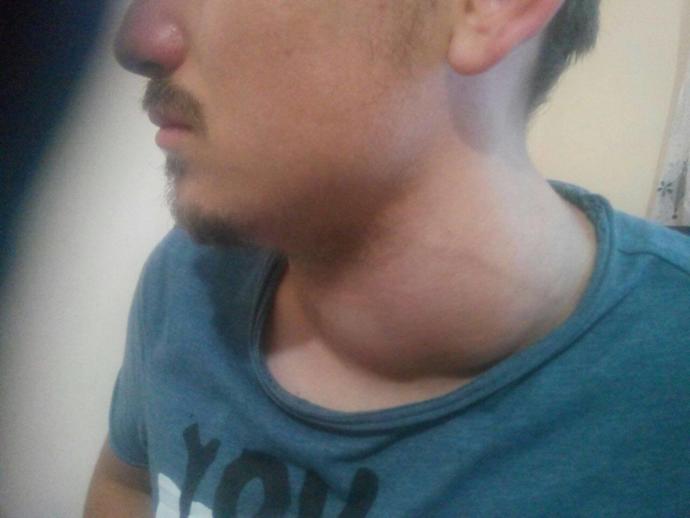 Kardeşimi kaybettik detayı okur musunuz?