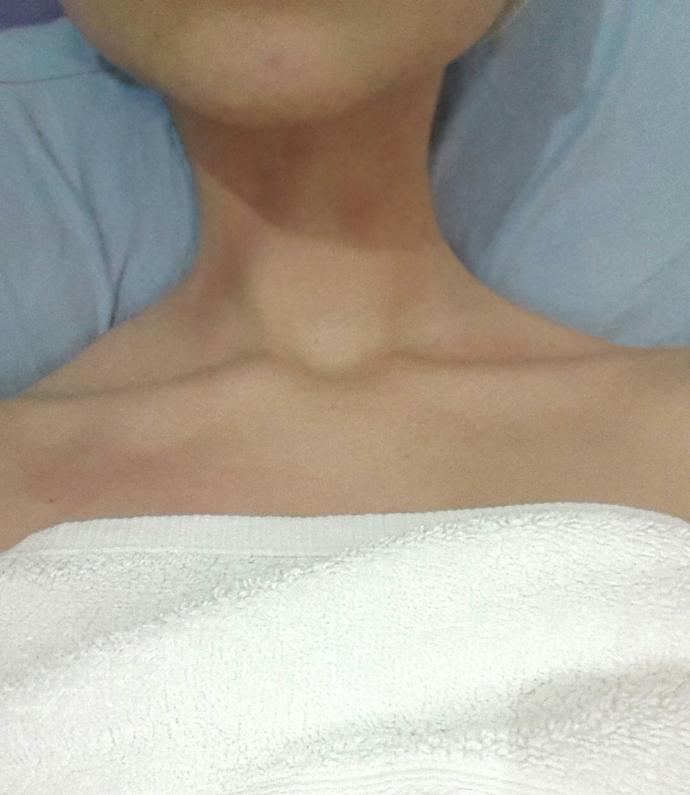 Boynum durdukyere kızardı?