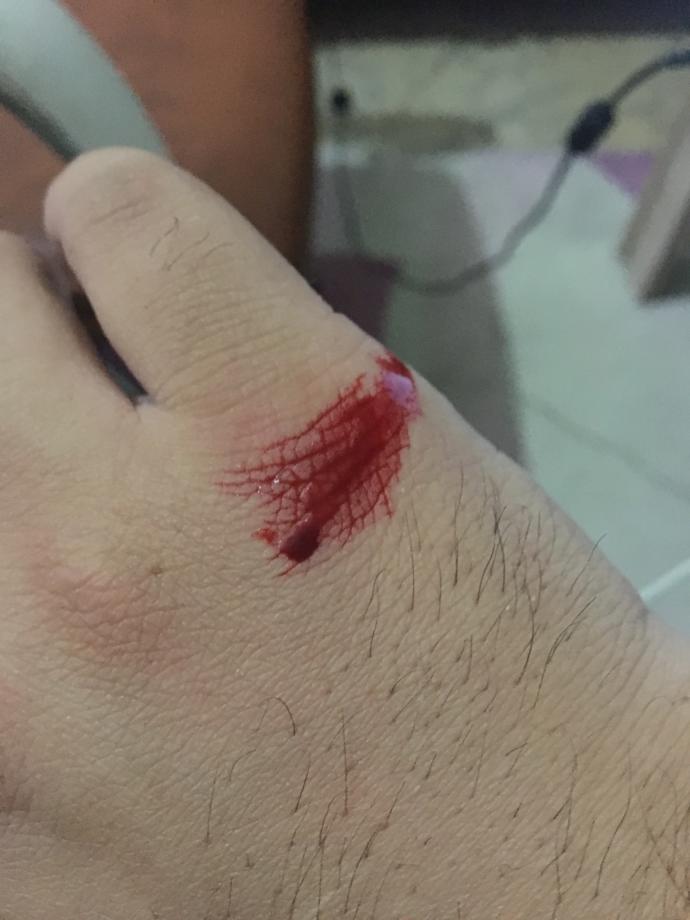 Akacak kan ilelebet damarda durmaz?