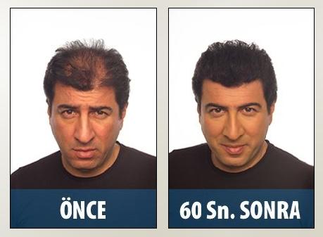 Bu Ünlülerin Toppik Kullandığını Biliyor muydunuz?