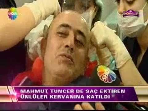 Bu Ünlülerin Toppik Kullandığını Biliyor muydunuz?