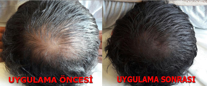 Toppik mi saç simülasyonu mu?