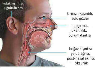 Allerji (Bahar Nezlesi) nin bir tedavisi yok mu??