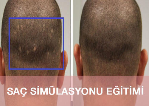 Saç simülasyonu yaptıran var mı?
