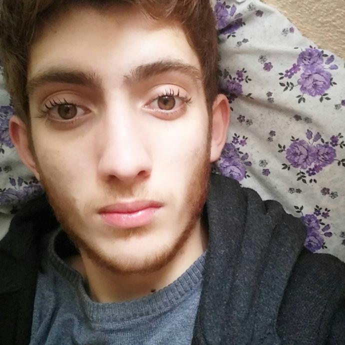 Kepçe kulak fotoğraflı?