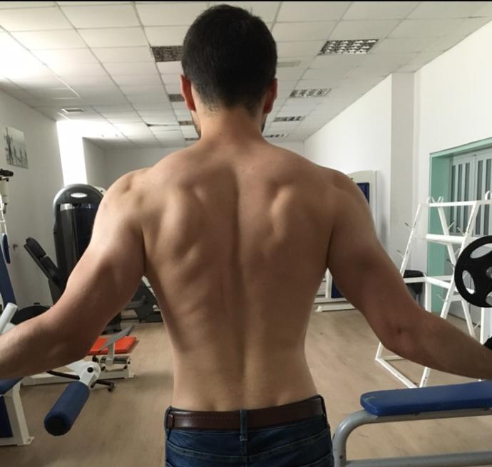 Kızlar, Tırnakla çizilmiş yara izi nasıl geçer 😩?