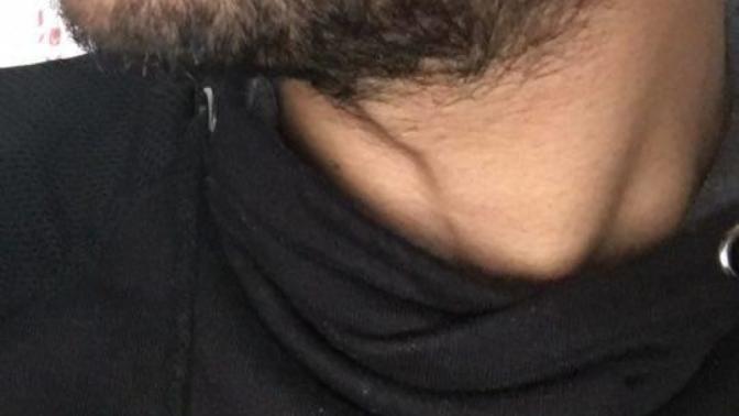 Yılan yağı ve badem yağı sakal çıkarır mı?