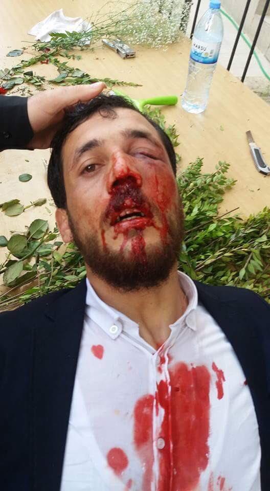 Furkan Vakfı ve Akp arasındaki olayda haklı taraf kim sizce?
