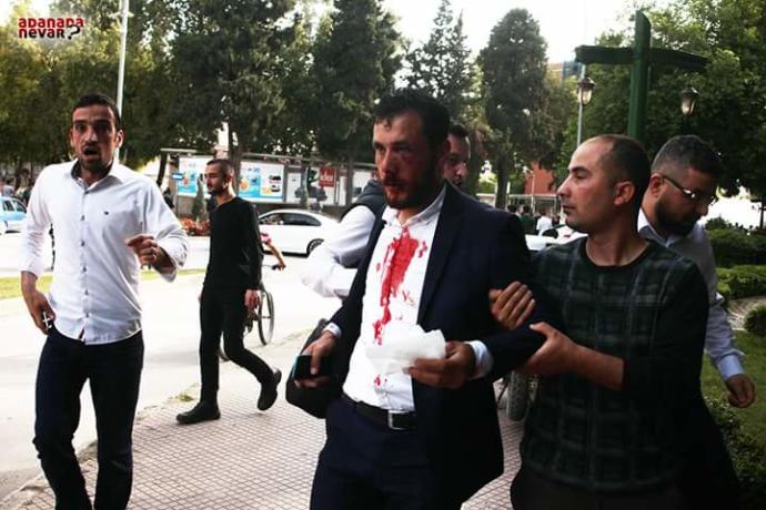 Furkan Vakfı ve Akp arasındaki olayda haklı taraf kim sizce?