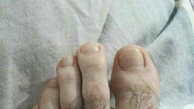 Ayak kıllarıma bakar mısınız? Annem izin vermiyor almama?